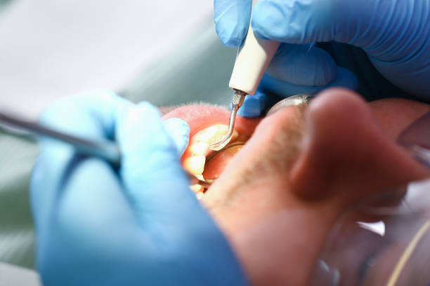 Best Weekend Emergency Dentist in Guntown, MS