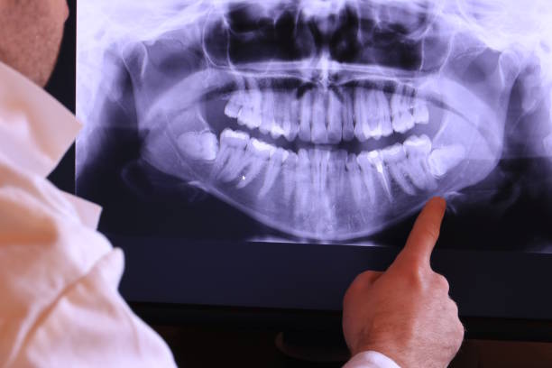 Best Emergency Tooth Extraction in Guntown, MS